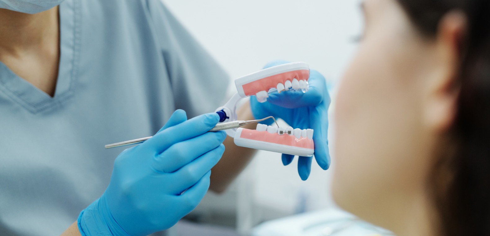 Microabrasion in aesthetic management of dental fluorosis stains